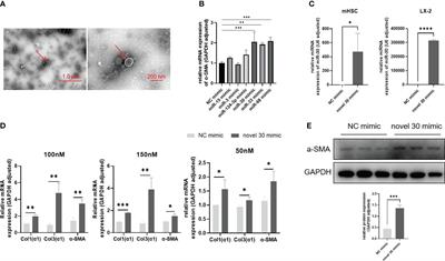 Induction of hepatic fibrosis in mice with schistosomiasis by extracellular microRNA-30 derived from Schistosoma japonicum eggs